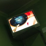 An operation live on a TV theatre.