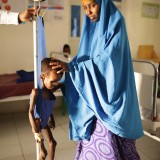 Being weighed. Niman, 2, suffers from severe malnutrition at Hargeisa Hospital.