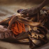 Seven month old malnourished baby girl Nadifo Isaak Hassan at Dusta Camp in Baidoa.